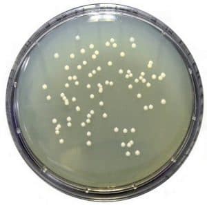 Tryptic Soy Agar Composition and (Vs Nutrient agar) - Laboratoryinfo.com