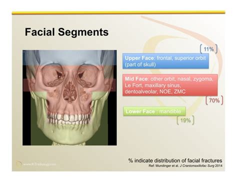 Imaging of Facial Trauma