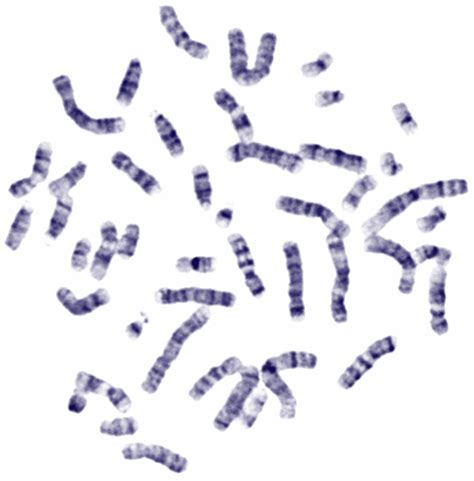 KaryoLogic | Karyotyping, Chromosome Analysis, Cytogenetics