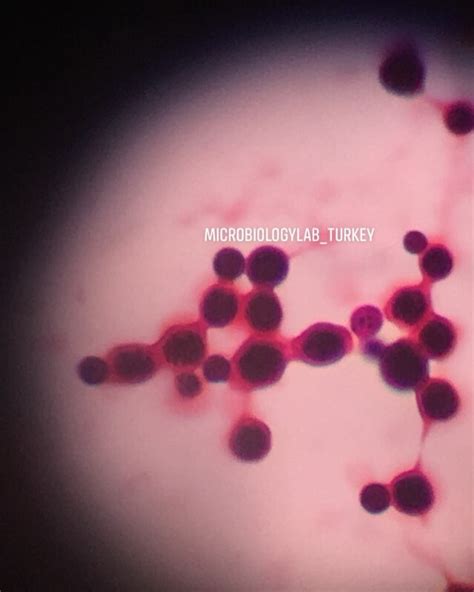 Cryptococcus neoformans 🔬💜😍#mikrobiyoloji #microbiology #microbiologia #microscope #laboratuvar ...