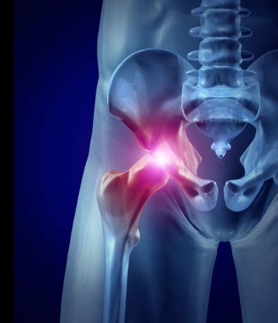 Acetabular Labrum Mri