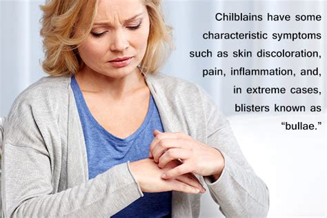 Chilblains: Causes, Symptoms, & Treatment - eMediHealth