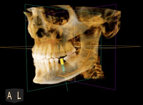 How Much Does A CBCT Scan Cost - Atlas Dental Toronto