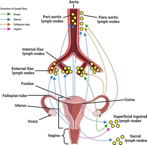 Lymphatic drainage of the ovary and uterus (A) The lymphatic vessels... | Download Scientific ...