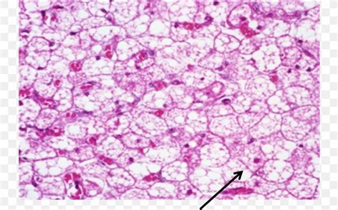 Brown Adipose Tissue Histology Connective Tissue, PNG, 953x595px ...