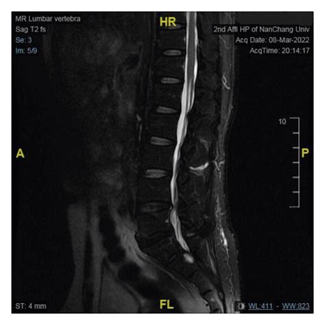 (a) T2-weighted image of MRI in the control group in 2022-1-14; (b) MRI ...