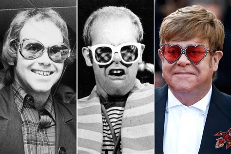 So What’s the Deal With Elton John’s Hair?