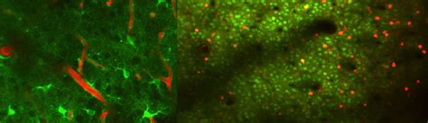 Two-photon imaging of brain dynamics: Illuminating neuronal and glial ...