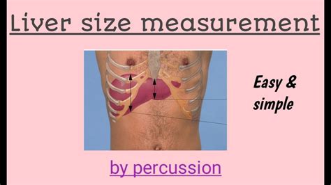 Liver span/ size measurement in health assessment (abdominal examination) by percussion.URDU ...