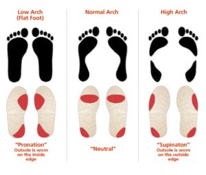 How Foot Movements Can Affect The Body | SoleScience - SoleScience - Orthotics, Gait Analysis ...