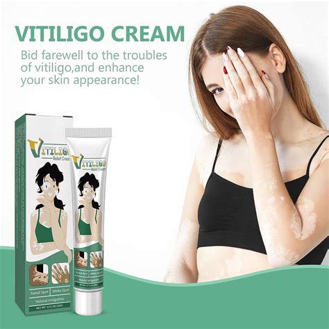 Vitiligo Cream Natural Vitiligo Treatment for Skin Vitiligo Vitiligo ...