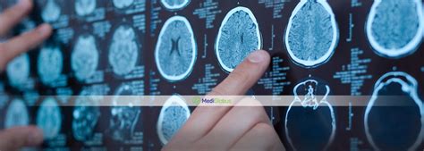 Meningioma Surgery - What You Need To Know? | Medical Tourism with ...