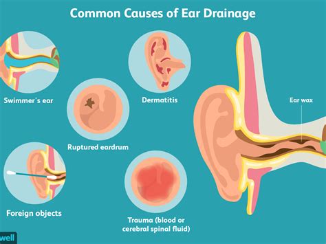 Ears Draining Fluid At Night - Best Drain Photos Primagem.Org