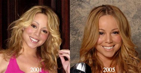 Mariah Carey Plastic Surgery Before And After Photos