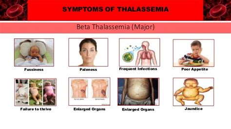 Thalassemia