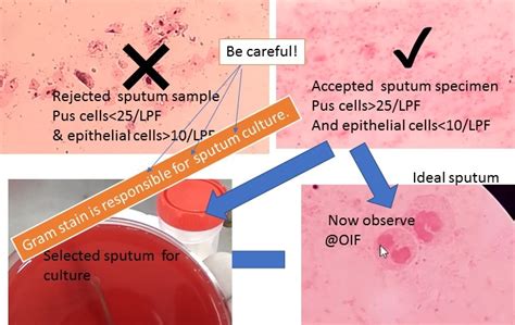 Sputum