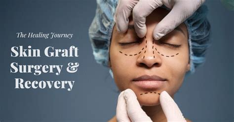 Unveiling the Wonders of Skin Graft Surgery: A Comprehensive Guide | by ...