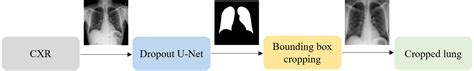 Detection and visualization of abnormality in chest radiographs using modality-specific ...