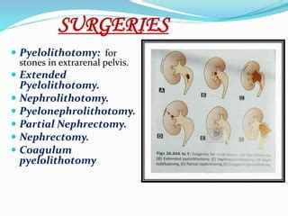 Stones & tumours of kidney ppt.- by Smriti singh