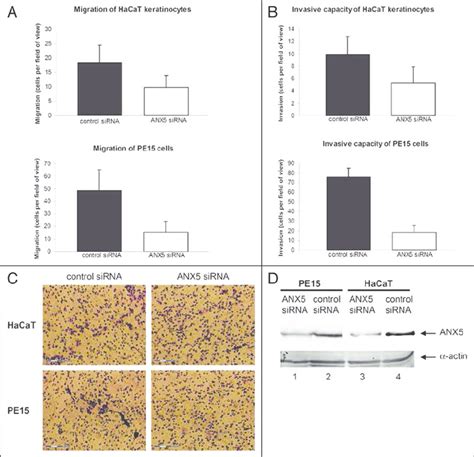 Analysis of migration and invasion capacity of HaCaT keratinocytes and ...