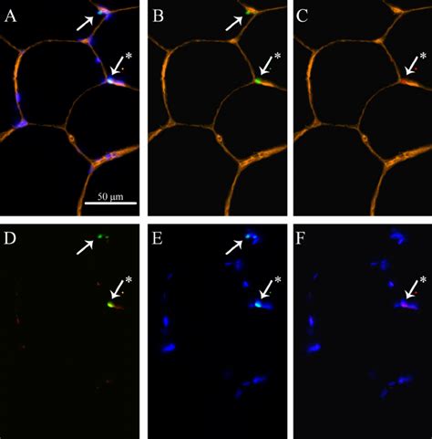 Representation of skeletal muscle satellite cells (SC) and MyoD in... | Download Scientific Diagram