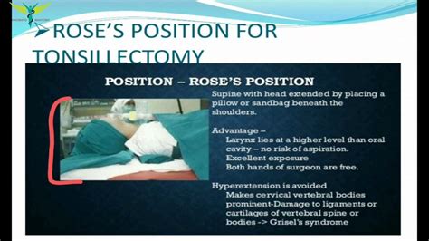 Tonsillectomy | ENT |Steps | Indications and contradictions | post operative care ...