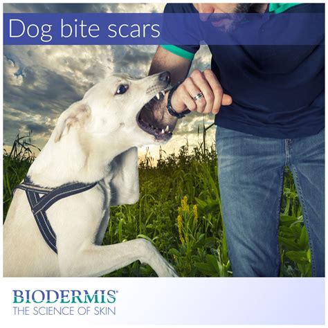 How to Effectively Treat Dog Bite Scars | Biodermis.com