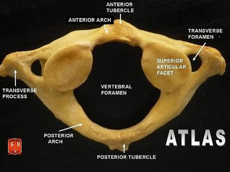 What is the Difference Between Atlas and Axis Vertebrae - Pediaa.Com | Anatomia humana huesos ...