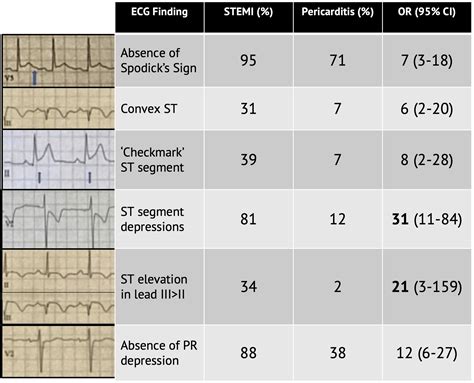 Stemi Vs Pericarditis Ecg