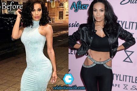 Erica Mena Plastic Surgery, Butt Breasts Reduction, Before After Pics ...