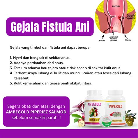 Fistula Ani – De Nature Indonesia