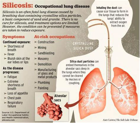 Daily Safety Briefs: 6/15/2011 The Hazards Of Silica Dust