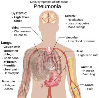 Pneumonia | Overview, Recovery & Possible Complications | Study.com