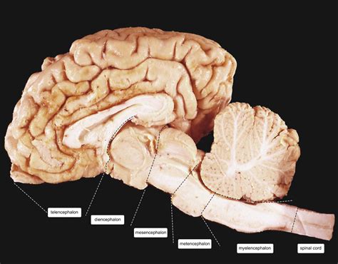 Cow Brain Compartments – Anatomie en Neurowetenschappen