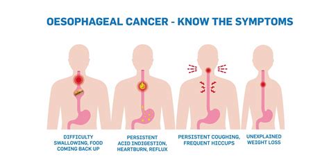 Upper Gastrointestinal Cancer Awareness - Aurora