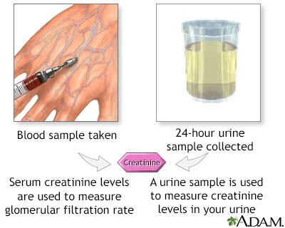 Creatinine blood test