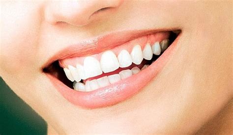 Tips to Maintain Healthy Gums - Indusladies.com