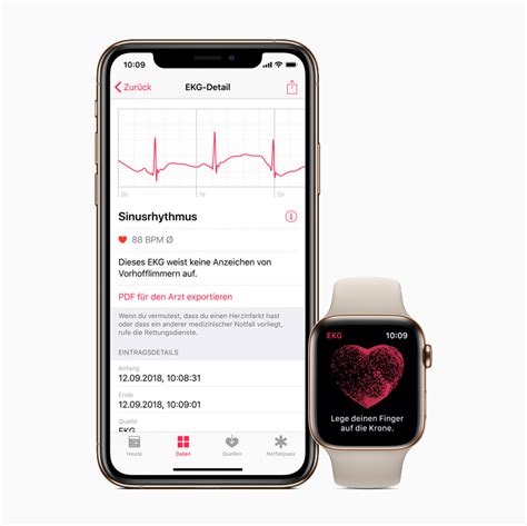 ECG app and irregular rhythm notification on Apple Watch available today across Europe and Hong Kong