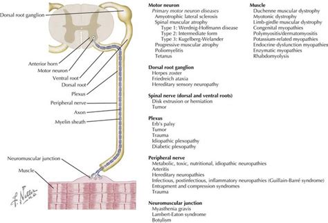 Neuromuscular Disorders | Obgyn Key