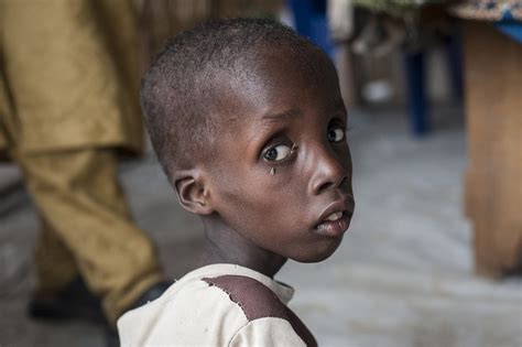 Um quarto das crianças que morrem em Moçambique estão desnutridas ...