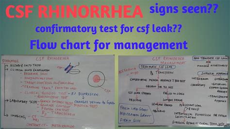 CSF Rhinorrhea - YouTube