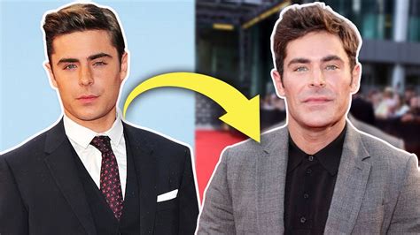 Zac Efron Reveals Truth Behind Plastic Surgery Jaw Rumors, 54% OFF