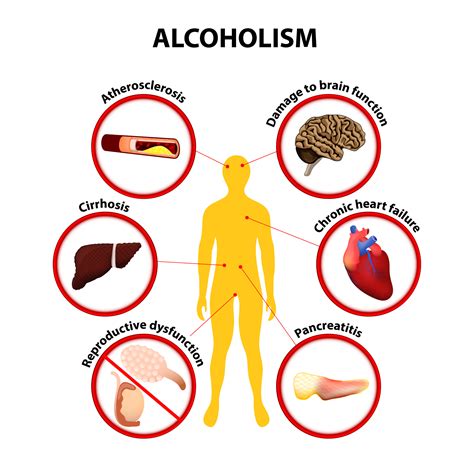 Can Alcoholism Negatively Impact Your Health? | RACNJ