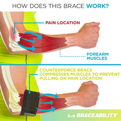 Tendonitis Counterforce Brace | Tennis & Golfers Elbow Support Strap