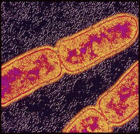 Mycobacterium Tuberculosis | Print patterns, Poster prints, Macro and micro