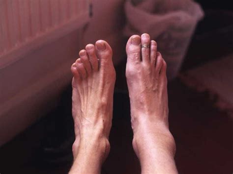 Foot Pain And Foot Problems - Business Insider