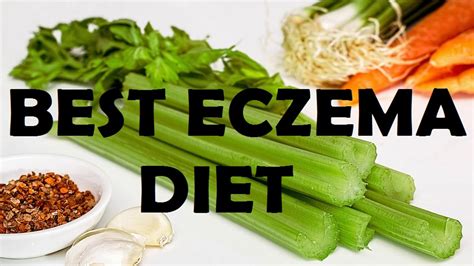 How To Cure Your Eczema Naturally | Best Eczema Diet - YouTube