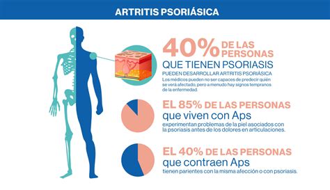 Artritis psoriásica - Principal | Novartis