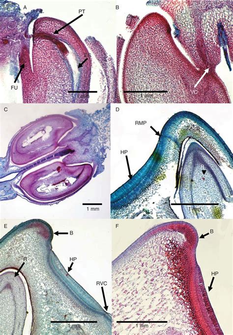 Development of seed at (A) 0 DAP, (B) 3 DAP, (C) 4 DAP, (D) 12 DAP, (E)... | Download Scientific ...