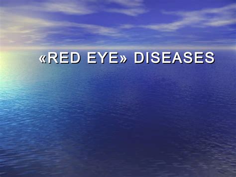 Red eye conjunctivitis | PPT